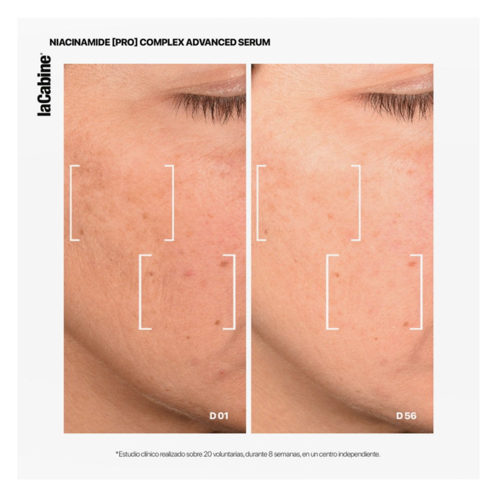LaCabine 25% Niacinamide Pro Complex Advanced Serum 30ml