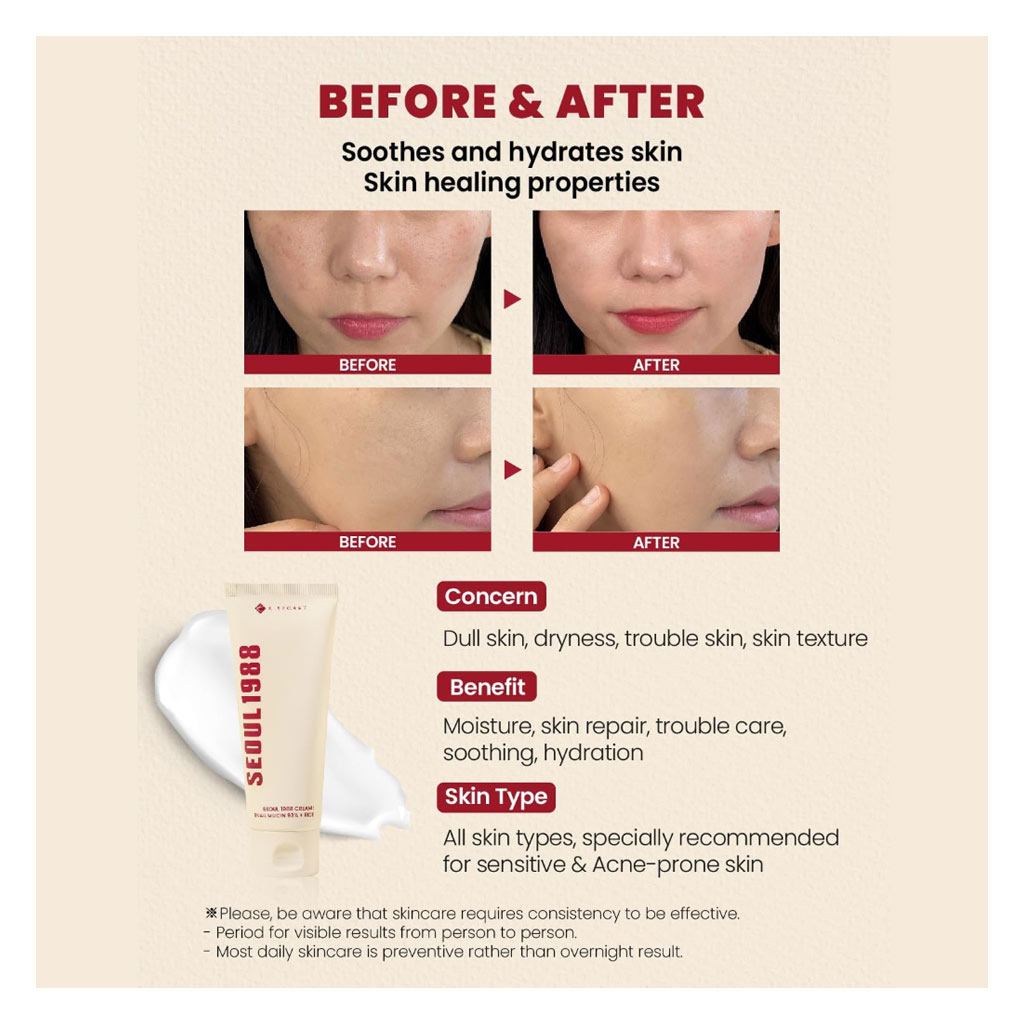 K-Secret Seoul 1988 Snail Mucin 93% + Rice Extract Cream 100ml