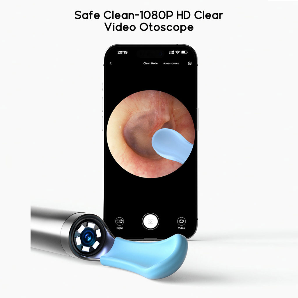 Bebird EarSight R1 Smart Earwax Removal Tool Kit