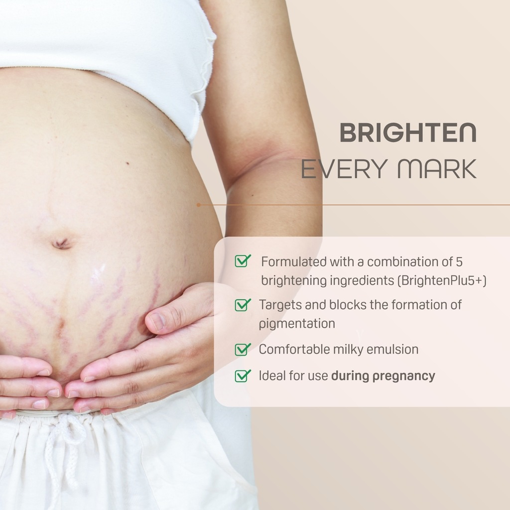 Pigeon Natural Botanical Maternity Stretch Marks Serum 40ml