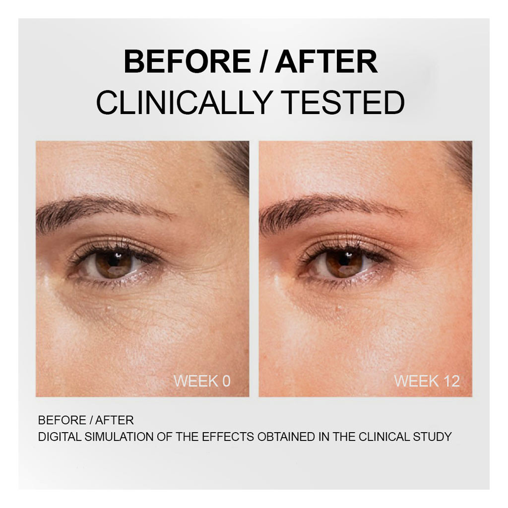 Vichy Liftactiv Collagen Specialist 16 Anti Aging Bonding Serum 30ml