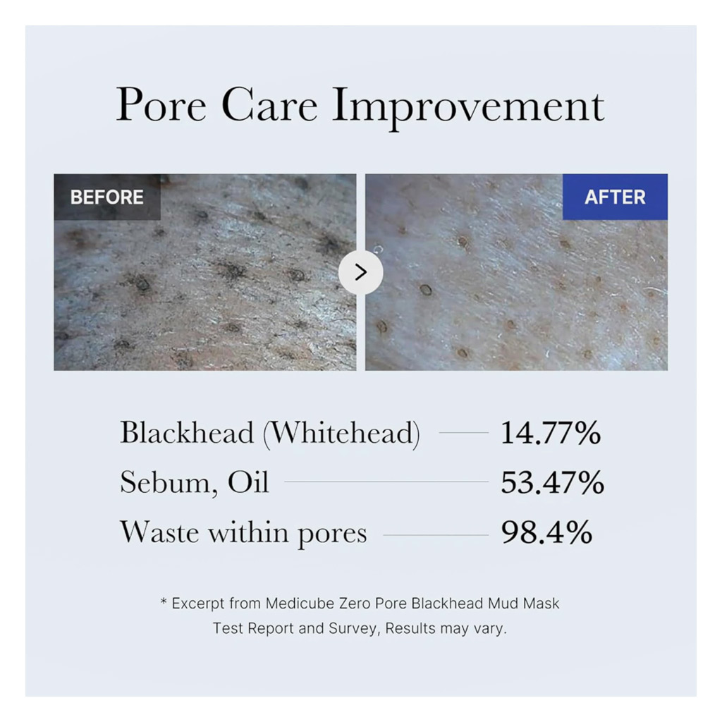 Medicube Zero Pore Blackhead Mud Facial Mask 100g