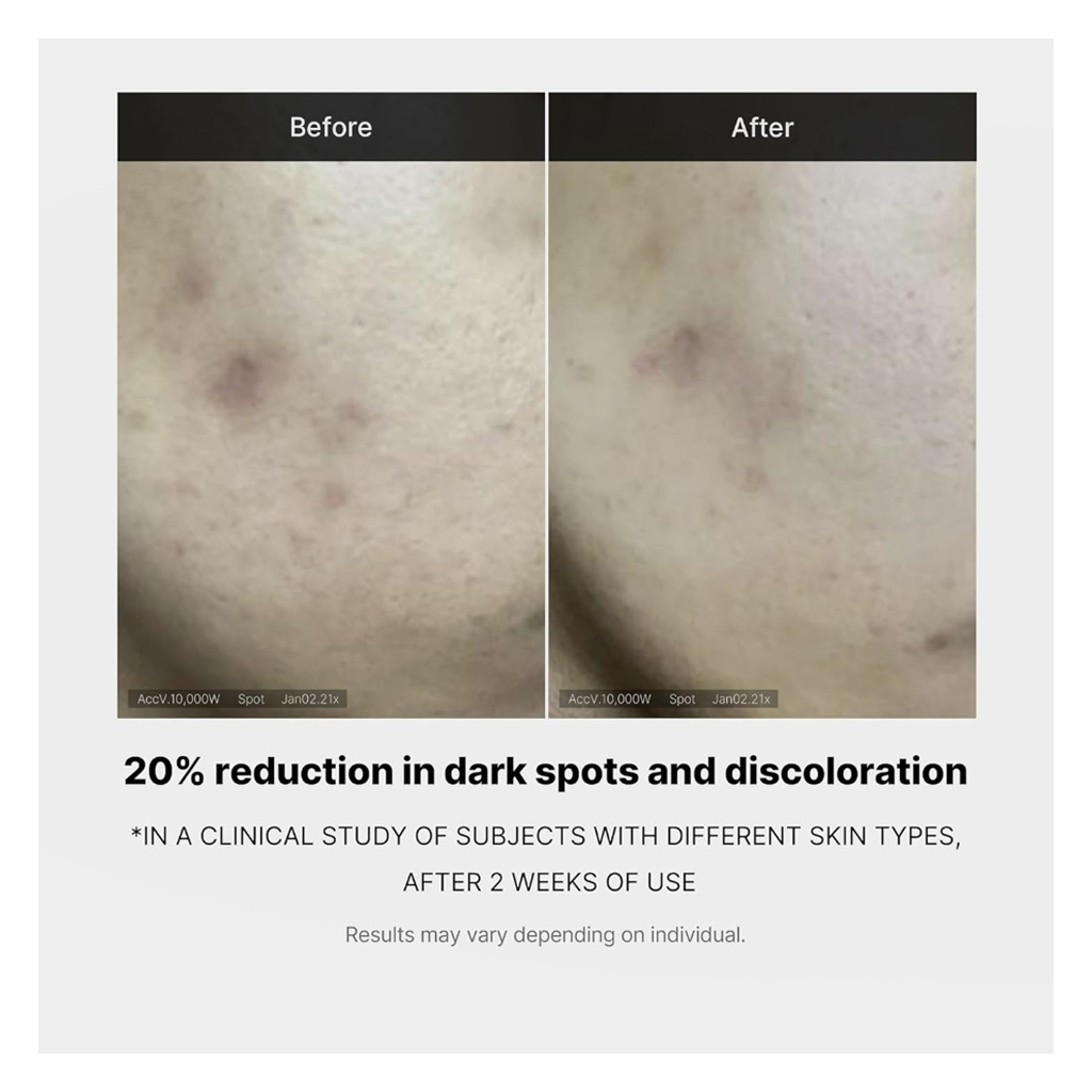 Medicube Deep Vita C 14.5% Ampoule For Skin Brightening 10ml, Pack of 3’s